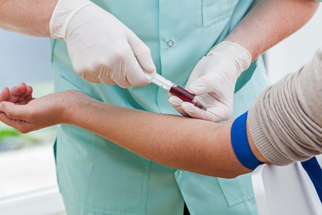 Blood Test