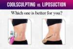 Cool-sculpting vs Laser Liposuction in Dubai
